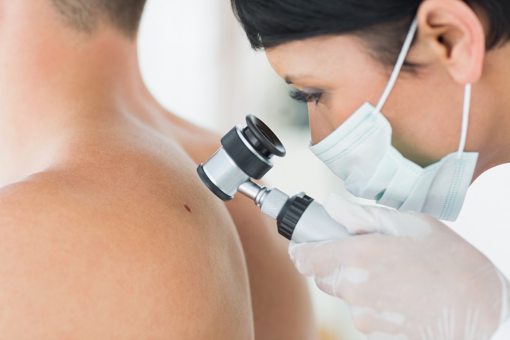 how to get rid of skin tags